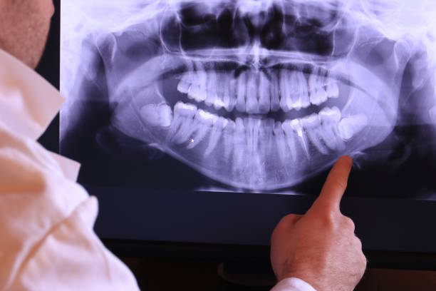 Best Emergency Root Canal Treatment in Winchester, IL