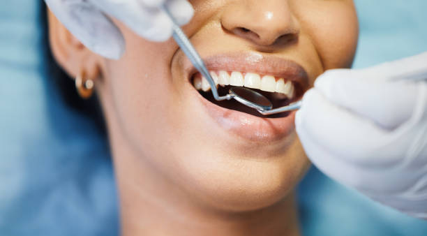 Best Emergency Tooth Extraction in Winchester, IL