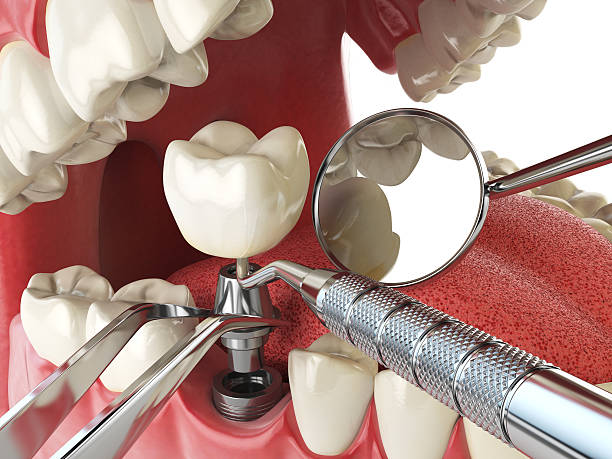 Best Emergency Gum Treatment in Winchester, IL