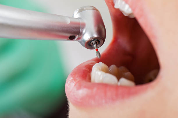 Best Emergency Gum Treatment in Winchester, IL